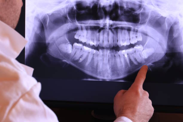 Best Emergency Gum Treatment in Clanton, AL