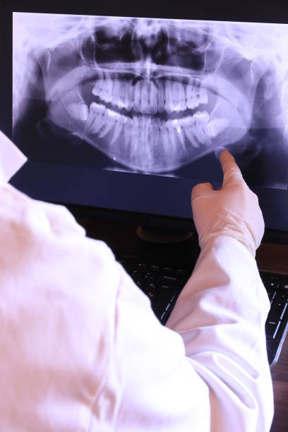 Best Emergency Wisdom Teeth Removal in Clanton, AL