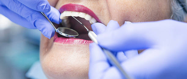 Best Emergency Tooth Extraction in Clanton, AL